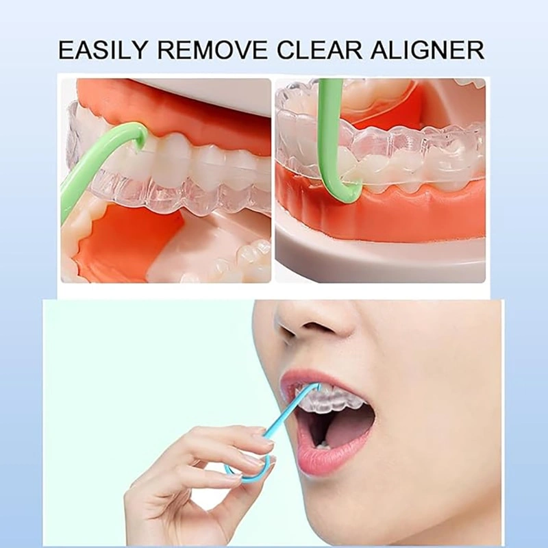 Aligners Remover Tool